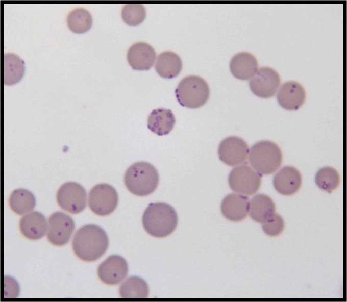 id-7-Mycoplasma-haemofilis-856x745.jpg